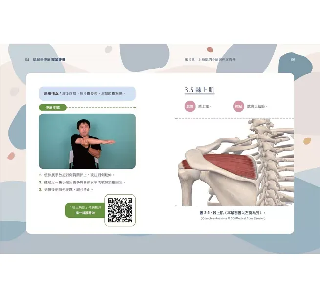 tc-93320_01 tc 93320 01